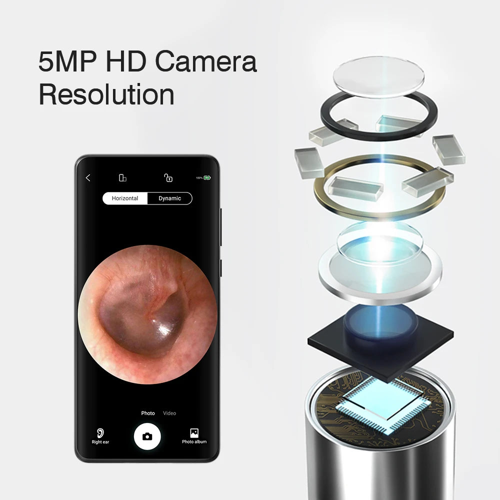 best otoscope for home use - KentDO