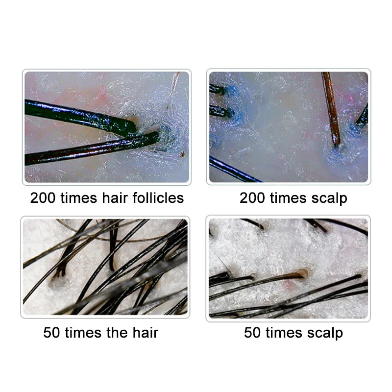 LCD Scalp Analyzer 50X/200X for Professional Hair Testing