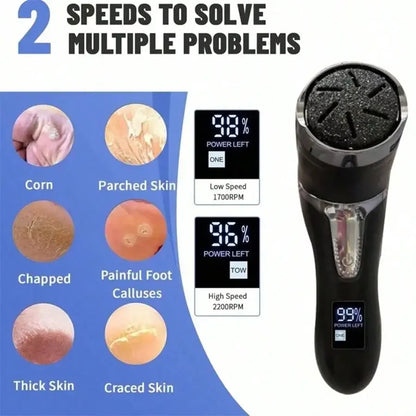KentDO™ Electric Foot Callus Remover – Dust-Free Smooth Pedicure