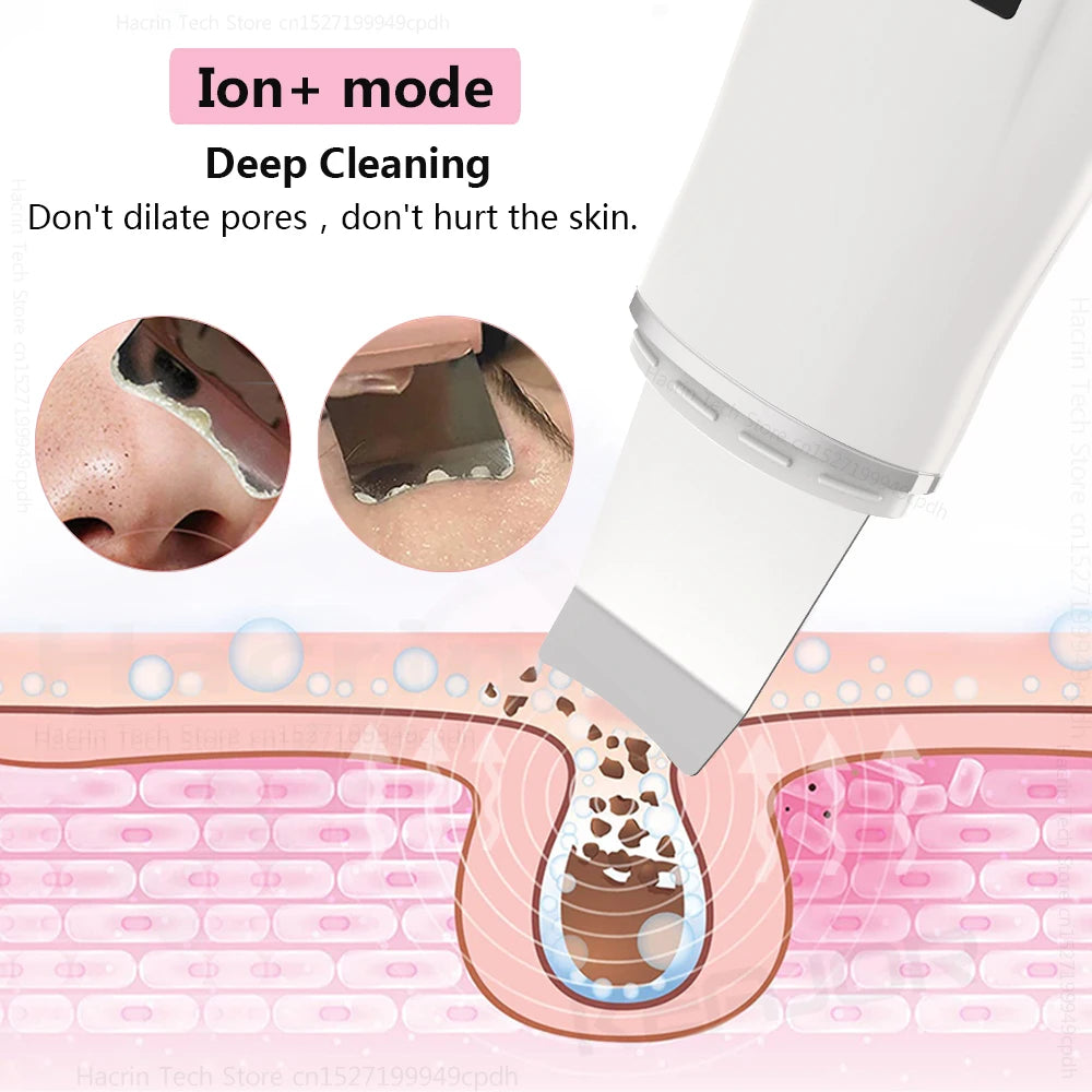 KentDO™ Ultrasonic Face Scrubber – Deep Pore Cleansing