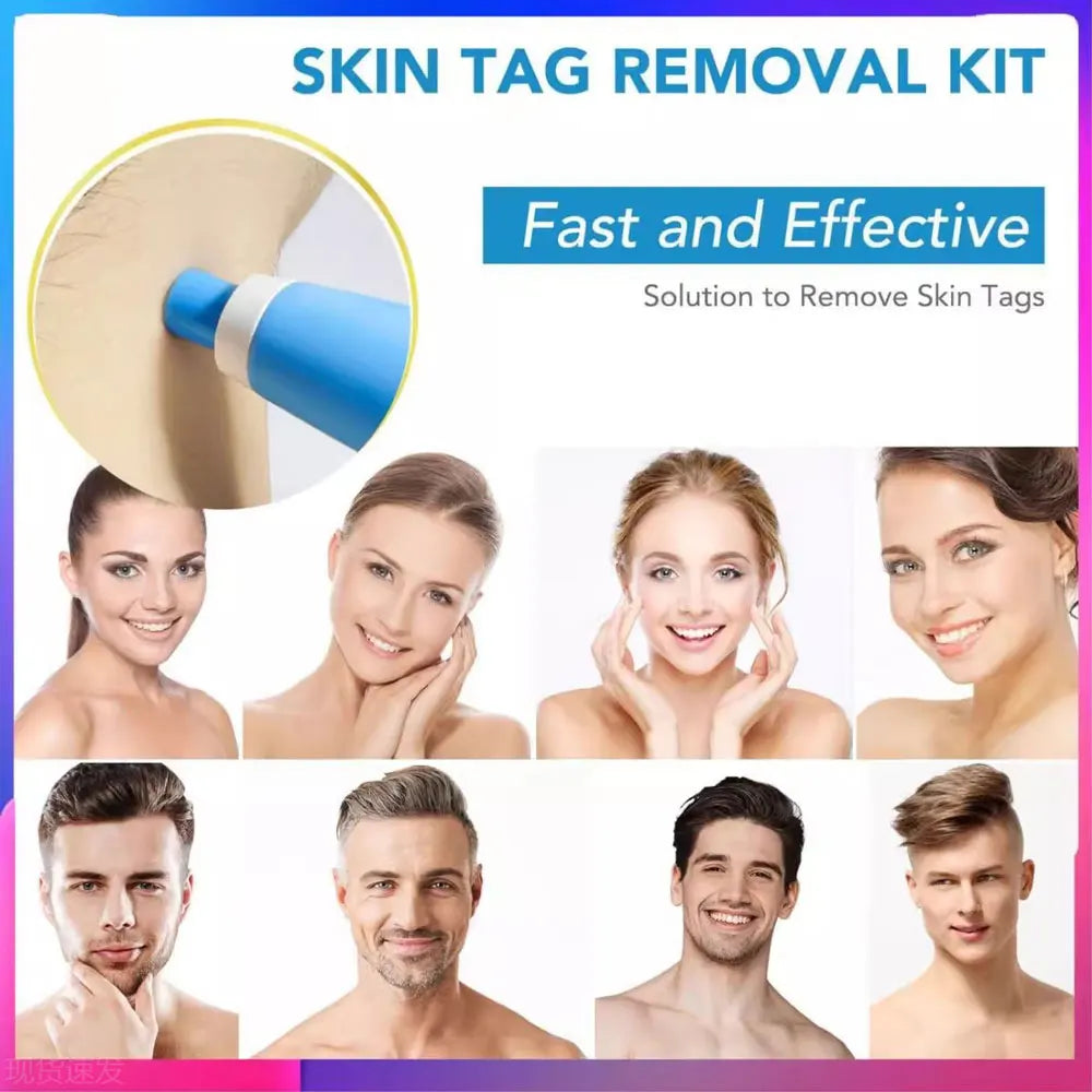 skin tag removal at home remedies - KentDO