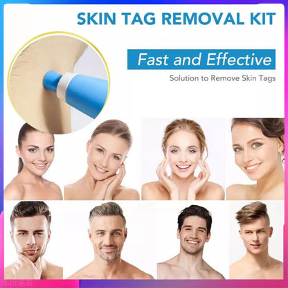 KentDO™ Double Head Wart Remover Pen – Safe Skin Tag Removal