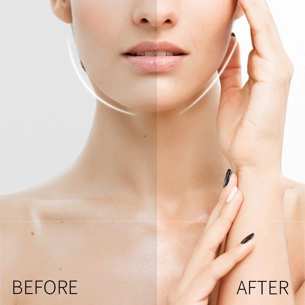 best treatment for deep wrinkles on face - KentDO