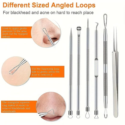 KentDO™ 6Pcs Pimple Tweezers Set – Pro Acne Care Tool