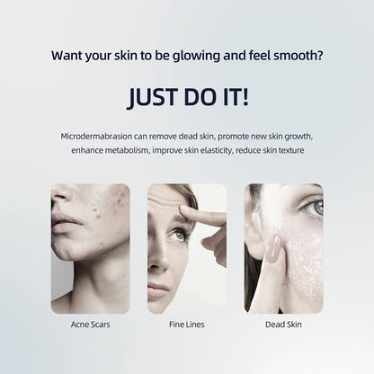 KentDO™ Diamond Microdermabrasion Machine for Smooth Skin