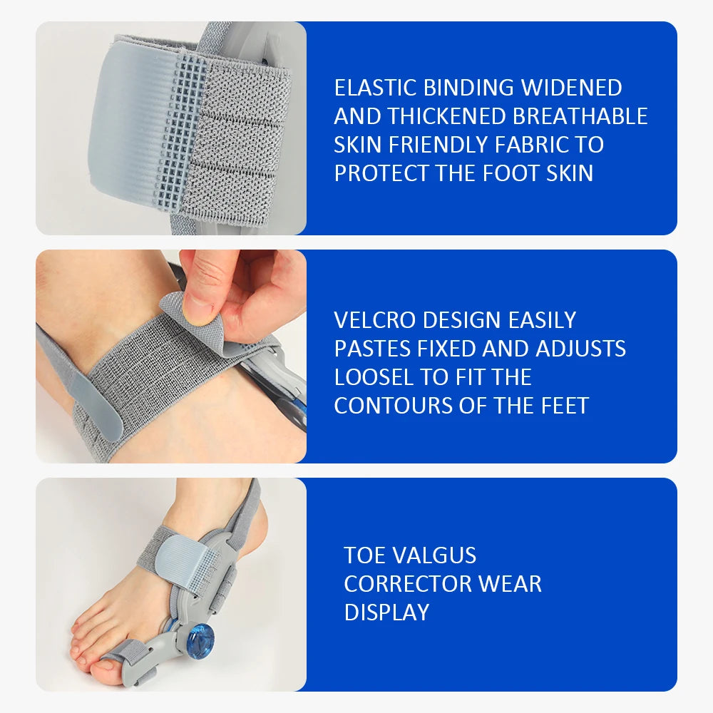 bunion corrector alignment support in daily use