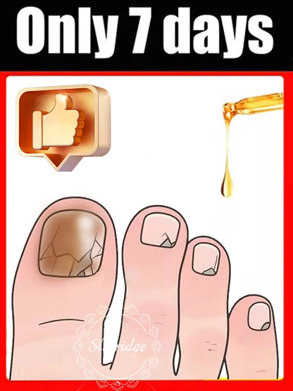 KentDO™ Toenail Fungus Patch – Waterproof Nail Repair Solution