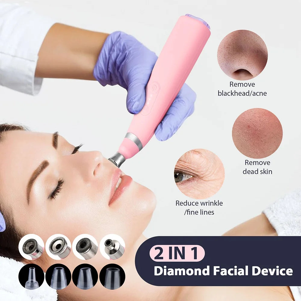 KentDO™ Diamond Microdermabrasion Machine for Smooth Skin