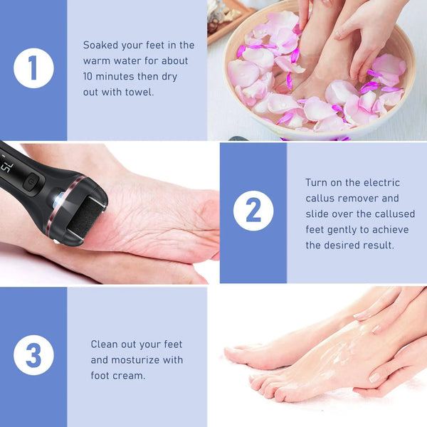 Rechargeable callus remover - smooth feet at home - KentDO