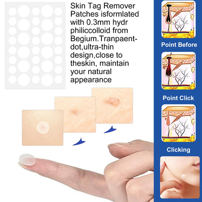 KentDO™ 2-in-1 Skin Tag & Mole Removal Kit – Painless Care