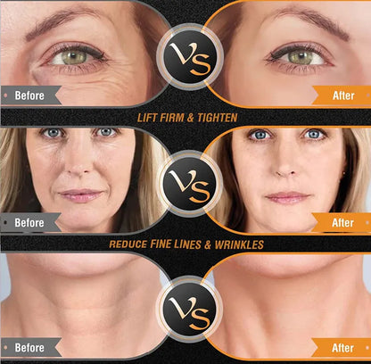 KentDO™ EMS RF Facial & Body Machine | Skin Tightening