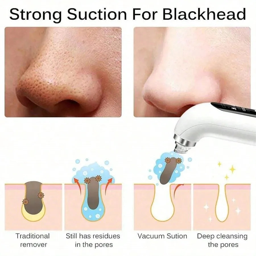 KentDO™ Pore Vacuum Blackhead Remover & Facial Cleaner
