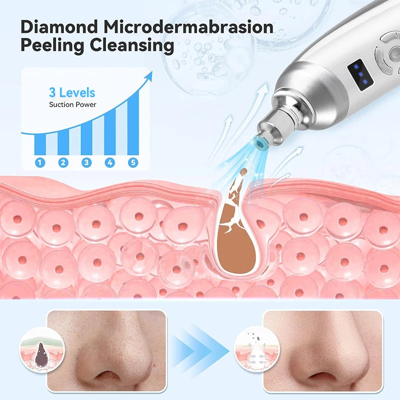 KentDO™ Diamond Microdermabrasion Machine – Pro Facial Skin Care