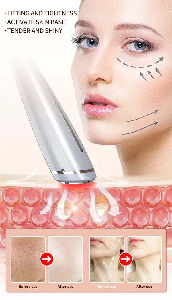 KentDO 6 in 1 EMS Facial Massager