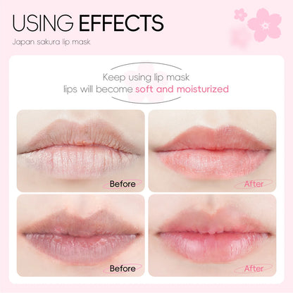 KentDO™ Cherry Blossom Lip Mask – Hydrating & Exfoliating Care