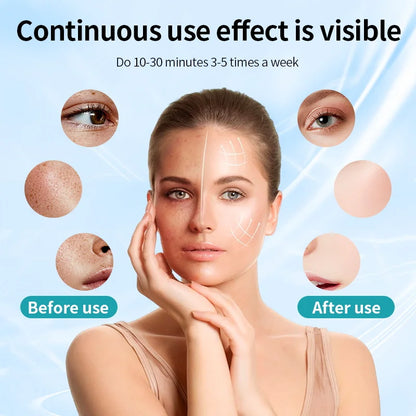 KentDO™ 7 Color LED Face Mask for Skin Rejuvenation