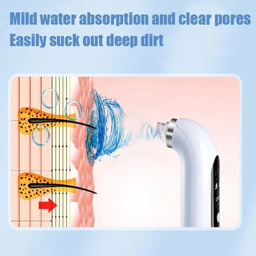 KentDO™ Pore Vacuum Blackhead Remover & Facial Cleaner