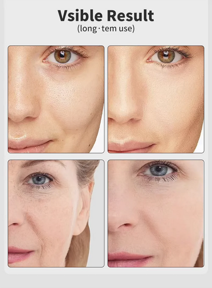 KentDO™ 7 Color LED Beauty Device – Microcurrent Anti-Aging Lift