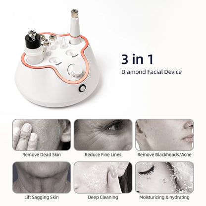 KentDO™ Diamond Microdermabrasion Machine for Smooth Skin