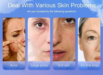 KentDO™ Portable Skin Analyzer – Moisture & Oil Tester