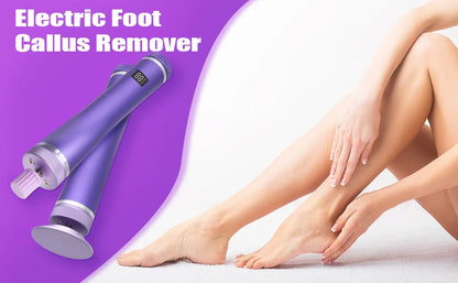 KentDO™ Electric Foot File – Smooth Heels & Callus Removal