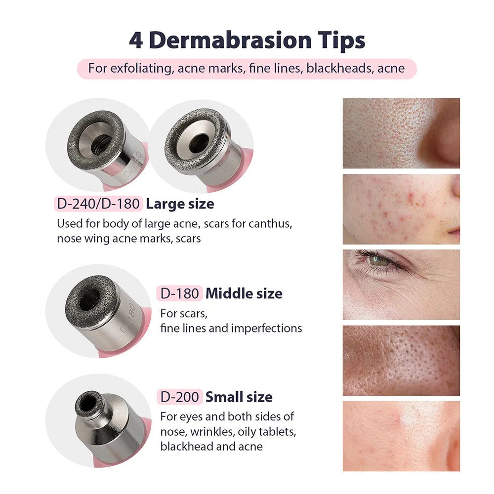 KentDO™ Diamond Microdermabrasion Machine for Smooth Skin