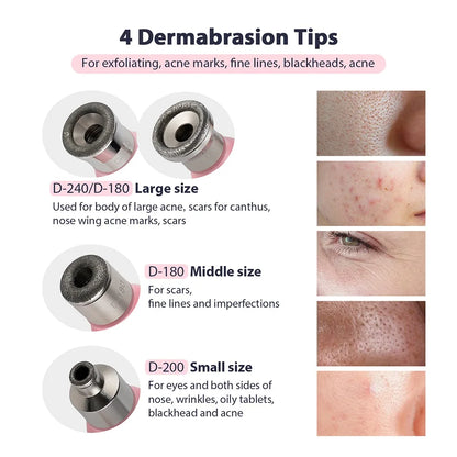 KentDO™ Diamond Microdermabrasion Machine for Smooth Skin