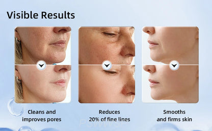 KentDO™ Neck & Facial Massager – Lift, Tighten & Rejuvenate Skin