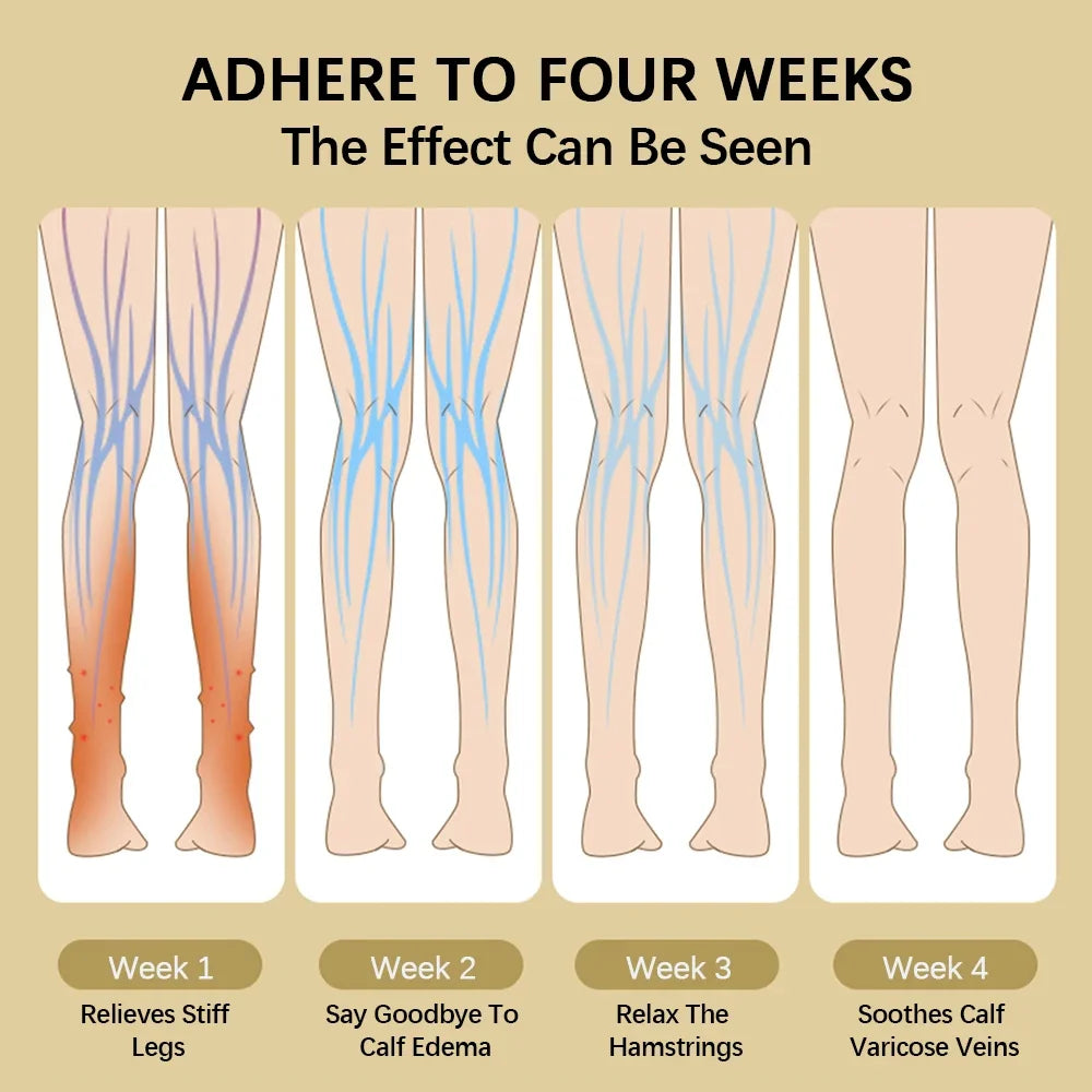 tired legs treatment - KentDO