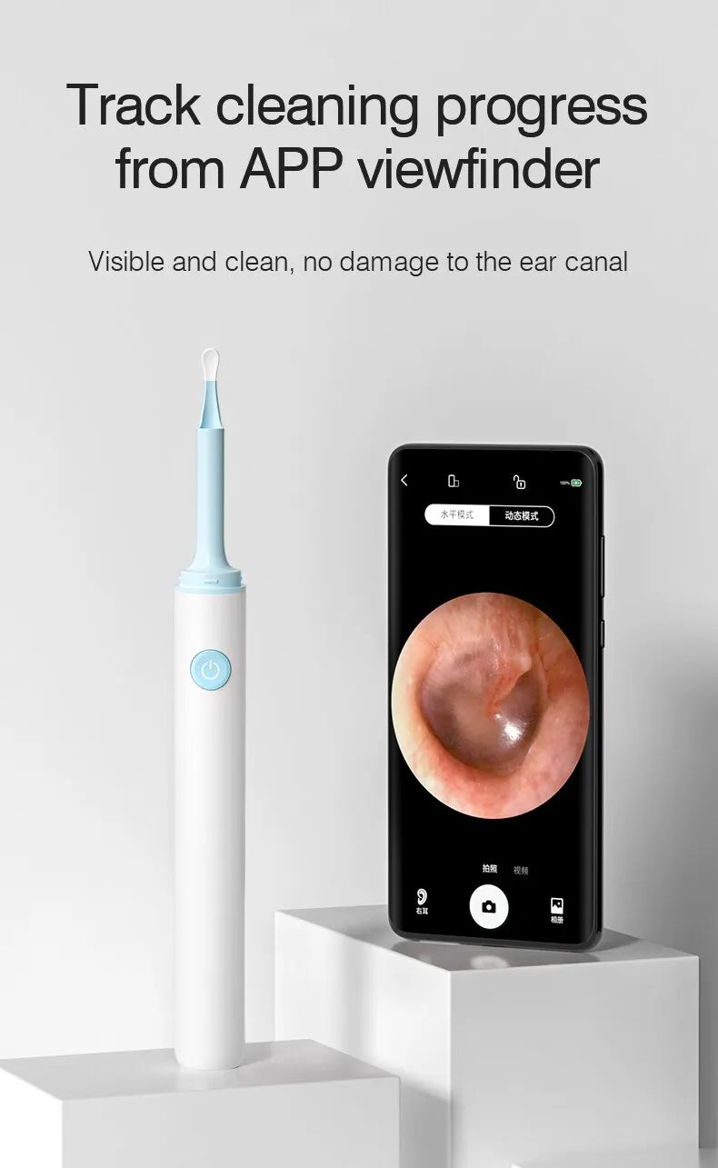 KentDO™ Wireless Visual Ear Cleaner