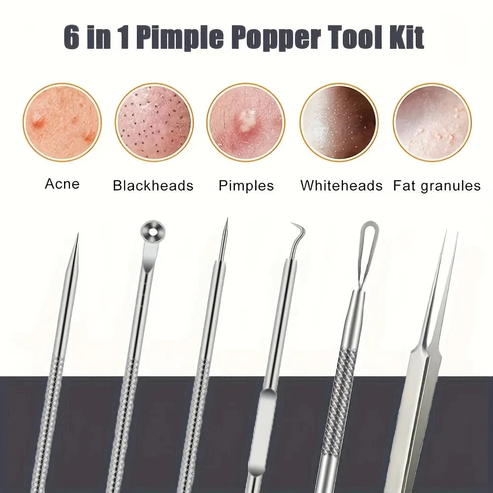 KentDO™ Pimple Popper Tool Kit – Clear Skin Blackhead Remover