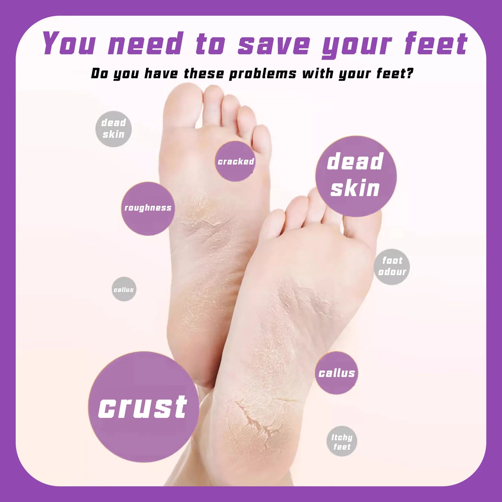 home treatment for calluses - KentDO